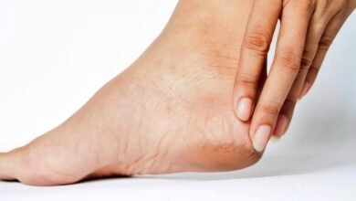 Vitamin deficiency can be the reason for cracked heels in winter, know which nutrients are needed