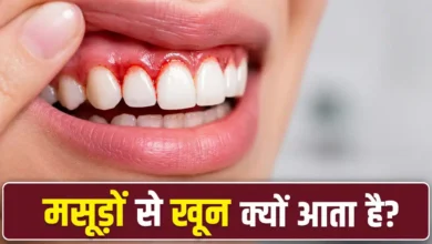 Gum Disease: Bleeding gums could be a sign of a serious condition! Find out when you should see a doctor immediately.