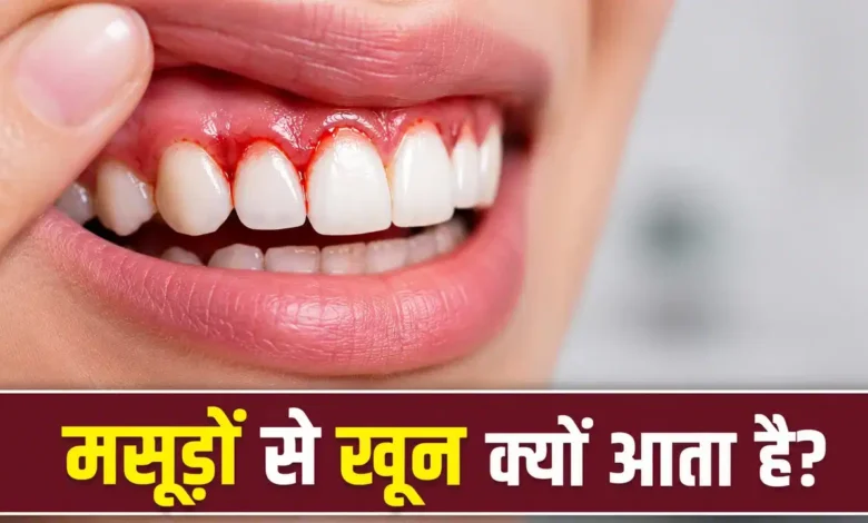 Gum Disease: Bleeding gums could be a sign of a serious condition! Find out when you should see a doctor immediately.