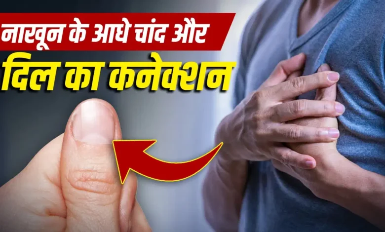 Half-Moon on Nails: Does the half-moon visible on the nail signal heart or kidney disease? Find out the expert's full opinion!